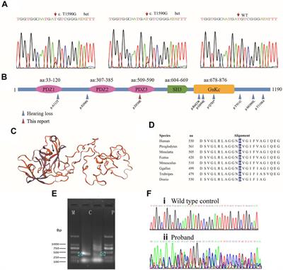 Case Report: Exome Sequencing Identified Variants in Three Candidate Genes From Two Families With Hearing Loss, Onychodystrophy, and Epilepsy